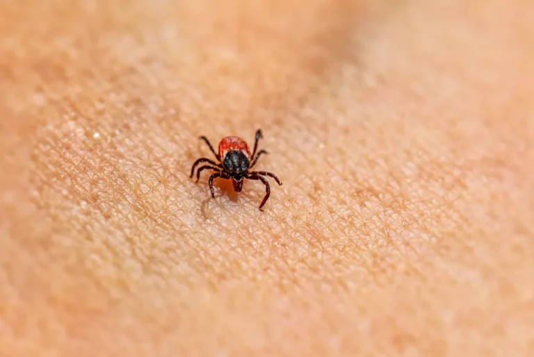 lone star tick allergy